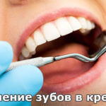 Лечение зубов в кредит Новости кредитования