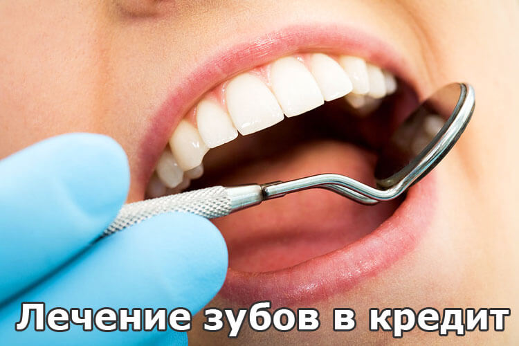 Кредит на лечение зубов – новый тренд в потребительском кредитовании